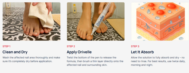 Orivelle Nail Fungus Pen